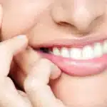 Tips Gigi Putih Bersih Secara Alami Dengan Cepat dan Ampuh